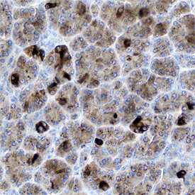 Tryptase e/BSSP-4 was detected in immersion fixed paraffin-embedded sections of human pancreas using Mouse Anti-Human Tryptase e/BSSP-4 Monoclonal Antibody (Catalog # MAB5047) at 15 µg/mL overnight at 4 °C. Before incubation with the primary antibody, tissue was subjected to heat-induced epitope retrieval using Antigen Retrieval Reagent-Basic (Catalog # CTS013). Tissue was stained using the Anti-Mouse HRP-DAB Cell & Tissue Staining Kit (brown; Catalog # CTS002) and counterstained with hematoxylin (blue). Specific staining was localized to cytoplasm in exocrine cells. View our protocol for Chromogenic IHC Staining of Paraffin-embedded Tissue Sections.
