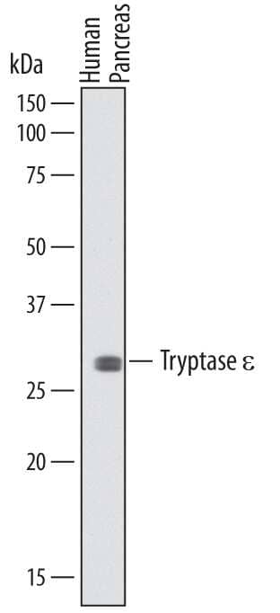 Western Blot Tryptase epsilon/BSSP-4/PRSS22 Antibody (725445)