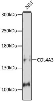 Tumstatin/COL4A3 Antibody (NBP3-02967): Novus Biologicals