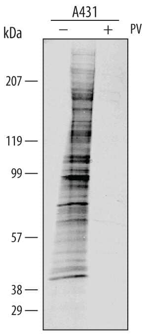 Western blot shows lysates of A431 human epithelial carcinoma cell line untreated (-) or treated (+) with 50 μM pervanadate (PV) for 15 minutes. PVDF membrane was probed with 1:1000 dilution of Phospho-Tyrosine AP-conjugated Monoclonal Antibody (Catalog # APM1676), followed by [Secondary Antibody Proper Name & Link]. Tyrosine-phosphorylated proteins were detected (as indicated). This experiment was conducted under reducing conditions and using Immunoblot Buffer Group XXX.