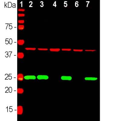 Western Blot: UCH-L1/PGP9.5 Antibody [NB110-58872] - Analysis of equal amounts of different tissue and cell lysates using chicken pAb to UCHL1, NB110-58872, dilution 1:2,000 in green, and mouse mAb to Actin, dilution 1:1,000, in red: [1] protein standard, [2] rat brain, [3] mouse brain, [4] NIH-3T3, [5] HEK293, [6] HeLa  and [7] SH-SY5Y cells. The single band at 24 kDa mark corresponds to UCHL1 protein which is detectable in CNS extracts and lysates of cells with neuronal properties but not in lysates of HeLa, NIH-3T3 and other non-neuronal cells. Actin is detected with apparent molecular weight of 42 kDa and provides an excellent loading control.