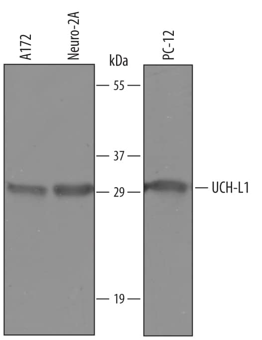 Western blot shows lysates of A172 human glioblastoma cell line, Neuro-2A mouse neuroblastoma cell line, PC-12 rat adrenal pheochromocytoma cell line. PVDF Membrane was probed with 1 µg/mL of Sheep Anti-Human/Mouse/ Rat UCH-L1/PGP9.5 Antigen Affinity-purified Polyclonal Antibody (Catalog # AF6007) followed by HRP-conjugated Anti-Sheep IgG Secondary Antibody (Catalog # HAF016). A specific band was detected for UCH-L1/PGP9.5 at approximately 29 kDa (as indicated). This experiment was conducted under reducing conditions and using Immunoblot Buffer Group 8.