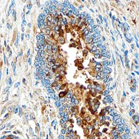 UCH-L1/PGP9.5 was detected in immersion fixed paraffin-embedded sections of human prostate using Mouse Anti-Human UCH-L1/PGP9.5 Monoclonal Antibody (Catalog # MAB6007) at 15 µg/mL overnight at 4 °C. Before incubation with the primary antibody, tissue was subjected to heat-induced epitope retrieval using Antigen Retrieval Reagent-Basic (Catalog # CTS013). Tissue was stained using the Anti-Mouse HRP-DAB Cell & Tissue Staining Kit (brown; Catalog # CTS002) and counterstained with hematoxylin (blue). Specific staining was localized to cytoplasm of glandular epithelial cells. View our protocol for Chromogenic IHC Staining of Paraffin-embedded Tissue Sections.