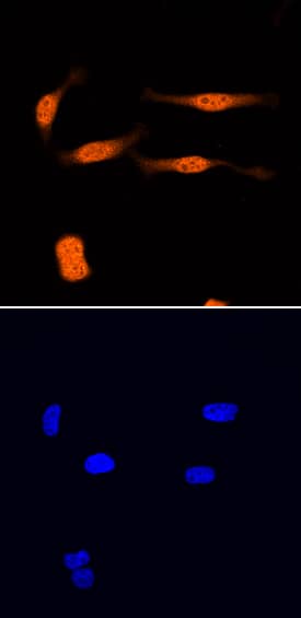 UFM1 was detected in immersion fixed HeLa human cervical epithelial carcinoma cell line using Sheep Anti-Human UFM1 Antigen Affinity-purified Polyclonal Antibody (Catalog # AF8237) at 1.7 µg/mL for 3 hours at room temperature. Cells were stained using the NorthernLights™ 557-conjugated Anti-Sheep IgG Secondary Antibody (red, upper panel; Catalog # NL010) and counterstained with DAPI (blue, lower panel). Specific staining was localized to nuclei. View our protocol for Fluorescent ICC Staining of Cells on Coverslips.