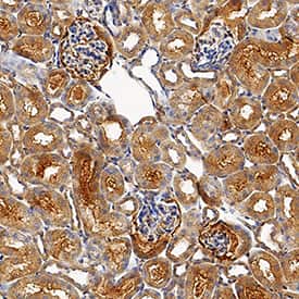    USP2  was detected in perfusion fixed frozen sections of mouse kidney using Goat  Anti-Mouse USP2 Antigen Affinity-purified Polyclonal Antibody (Catalog #  AF5804) at 3 µg/mL for 1 hour at room temperature followed  by incubation with the Anti-Goat IgG VisUCyte™ HRP Polymer Antibody  (Catalog # VC004).  Tissue was stained using DAB (brown) and counterstained with hematoxylin  (blue).  Specific staining was  localized to cytoplasm in glandular epithelial cells. View our protocol for  IHC  Staining with VisUCyte HRP Polymer Detection Reagents. 