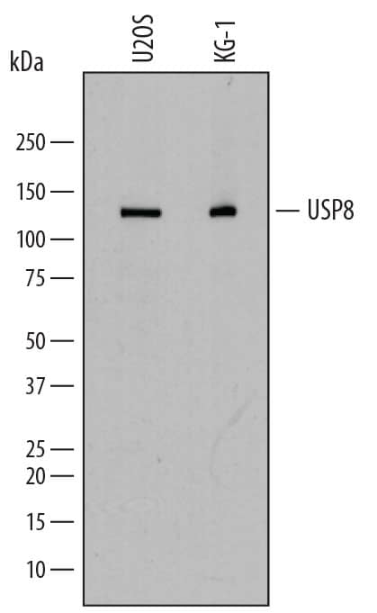 Western blot shows lysates of U2OS human osteosarcoma cell line and KG-1 human acute myelogenous leukemia cell line. PVDF membrane was probed with 1 µg/mL of Sheep Anti-Human USP8 Antigen Affinity-purified Polyclonal Antibody (Catalog # AF7735) followed by HRP-conjugated Anti-Sheep IgG Secondary Antibody (Catalog # HAF016). A specific band was detected for USP8 at approximately 130 kDa (as indicated). This experiment was conducted under reducing conditions and using Immunoblot Buffer Group 1.