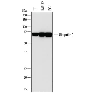 Western Blot Ubiquilin 1 Antibody