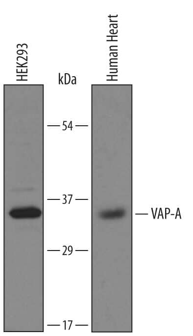 Western blot shows lysates of HEK293 human embryonic kidney cell line and human heart tissue. PVDF membrane was probed with 1 µg/mL of Sheep Anti- Human VAP-A Antigen Affinity-purified Polyclonal Antibody (Catalog # AF5820) followed by HRP-conjugated Anti-Sheep IgG Secondary Antibody (Catalog # HAF016). A specific band was detected for VAP-A at approximately 33 kDa (as indicated). This experiment was conducted under reducing conditions and using Immunoblot Buffer Group 8.