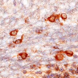 Immunohistochemistry VAP-B Antibody (736904)