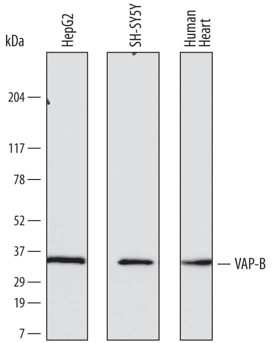 Western Blot VAP-B Antibody (736904)