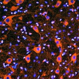 VAP‑B was detected in perfusion fixed frozen sections of rat brain (medulla) using Mouse Anti-Rat VAP‑B Monoclonal Antibody (Catalog # MAB7329) at 8 µg/mL overnight at 4 °C. Tissue was stained using the NorthernLights™ 557-conjugated Anti-Mouse IgG Secondary Antibody (red; Catalog # NL007) and counterstained with DAPI (blue). Specific staining was localized to gigantocellular neurons. View our protocol for Fluorescent IHC Staining of Frozen Tissue Sections.