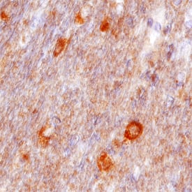 VAP-B was detected in immersion fixed paraffin-embedded sections of human brain (cerebellum) using Sheep Anti-Human VAP-B Antigen Affinity-purified Polyclonal Antibody (Catalog # AF5855) at 10 µg/mL overnight at 4 °C. Before incubation with the primary antibody, tissue was subjected to heat-induced epitope retrieval using Antigen Retrieval Reagent-Basic (Catalog # CTS013). Tissue was stained using the Anti-Sheep HRP-DAB Cell & Tissue Staining Kit (brown; Catalog # CTS019) and counter-stained with hematoxylin (blue). Specific staining was localized to neuronal cell bodies. View our protocol for Chromogenic IHC Staining of Paraffin-embedded Tissue Sections.