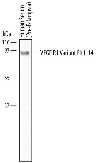 Western blot shows human serum (preeclampsia). PVDF Membrane was probed with 2 µg/mL of Human VEGFR1/Flt-1 Variant Flt1-14 Monoclonal Antibody (Catalog # MAB6564) followed by HRP-conjugated Anti-Mouse IgG Secondary Antibody (Catalog # HAF007). A specific band was detected for VEGFR1/Flt-1 Variant Flt1-14 at approximately 90 kDa (as indicated). This experiment was conducted under non-reducing conditions and using Immunoblot Buffer Group 10.