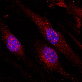 VG5Q was detected in immersion fixed bEnd.3 mouse endothelioma cell line using Rat Anti-Mouse VG5Q Monoclonal Antibody (Catalog # MAB30481) at 10 µg/mL for 3 hours at room temperature. Cells were stained using the NorthernLights™ 557-conjugated Anti-Rat IgG Secondary Antibody (red; Catalog # NL013) and counterstained with DAPI (blue). Specific staining was localized to cytoplasm and nuclei. View our protocol for Fluorescent ICC Staining of Cells on Coverslips.