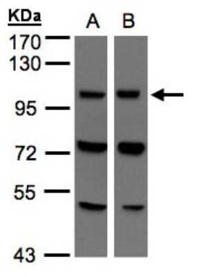 VPS11 Antibody (NBP1-31054): Novus Biologicals