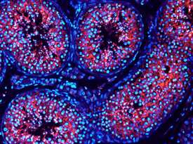 VSIG1 was detected in immersion fixed frozen sections of human testis using 10 µg/mL Sheep Anti-Human VSIG1 Antigen Affinity-purified Polyclonal Antibody (Catalog # AF4818) overnight at 4 °C. Tissue was stained with the NorthernLights™ 557-conjugated Anti-Sheep IgG Secondary Antibody (red; Catalog # NL010) and counterstained with DAPI (blue). View our protocol for Fluorescent IHC Staining of Frozen Tissue Sections.