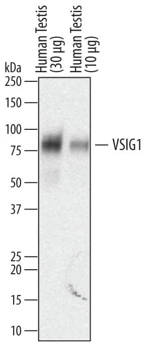 Western blot shows lysates of human testis tissue. PVDF membrane was probed with 0.2 µg/mL of Sheep Anti-Human VSIG1 Antigen Affinity-purified Polyclonal Antibody (Catalog # AF4818) followed by HRP-conjugated Anti-Sheep IgG Secondary Antibody (Catalog # HAF016). A specific band was detected for VSIG1 at approximately 80 kDa (as indicated). This experiment was conducted under reducing conditions and using Immunoblot Buffer Group 1.