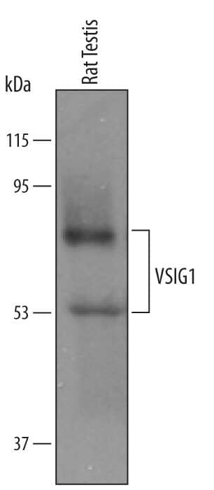 Western blot shows lysates of rat testis tissue. PVDF membrane was probed with 1 µg/mL of Goat Anti-Mouse/Rat VSIG1 Antigen Affinity-purified Polyclonal Antibody (Catalog # AF5324) followed by HRP-conjugated Anti-Goat IgG Secondary Antibody (Catalog # HAF019). Specific bands were detected for VSIG1 at approximately 55 and 70 kDa (as indicated). This experiment was conducted under reducing conditions and using Immunoblot Buffer Group 8.