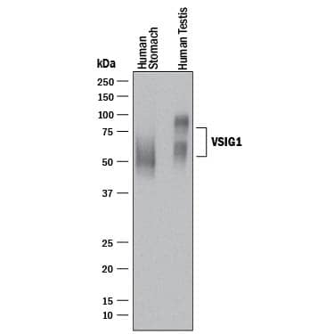Western blot shows lysates of human stomach tissue and human testis tissue. PVDF membrane was probed with 0.5 µg/mL of Rabbit Anti-Human VSIG1 Monoclonal Antibody (Catalog # MAB48181) followed by HRP-conjugated Anti-Rabbit IgG Secondary Antibody (Catalog # HAF008). Specific bands were detected for VSIG1 at approximately 55-75 kDa (as indicated). This experiment was conducted under reducing conditions and using Immunoblot Buffer Group 1.