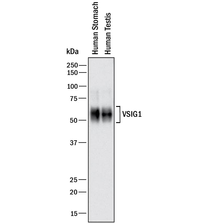 Western blot shows lysates of human stomach tissue and human testis tissue. PVDF membrane was probed with 2 µg/mL of Mouse Anti-Human VSIG1 Monoclonal Antibody (Catalog # MAB48182) followed by HRP-conjugated Anti-Mouse IgG Secondary Antibody (Catalog # HAF018). A specific band was detected for VSIG1 at approximately 50-65 kDa (as indicated). This experiment was conducted under reducing conditions and using Immunoblot Buffer Group 1.