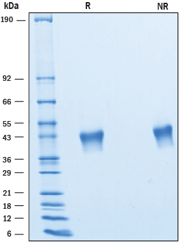 2 μg/lane of Recombinant Human VSTM2B was resolved with SDS-PAGE underreducing (R) and non-reducing (NR) conditions and visualized by Coomassie® Bluestaining, showing bands at 37 - 45 kDa.