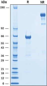 2 μg/lane of Recombinant Mouse VSTM2B Fc Chimera was resolved with SDS-PAGE underreducing (R) and non-reducing (NR) conditions and visualized by Coomassie® Bluestaining, showing bands at 61-70 kDa and 120-140 kDa, respectively.
