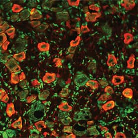 Vanilloid R1/TRPV1 was detected in perfusion fixed frozen sections of rat dorsal root ganglion using 15 µg/mL Goat Anti-Rat Vanilloid R1/TRPV1 Antigen Affinity-purified Polyclonal Antibody (Catalog # AF3066) overnight at 4 °C. Tissue was stained (red) and counterstained (green). View our protocol for Fluorescent IHC Staining of Frozen Tissue Sections.