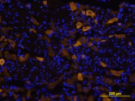 Vanilloid R1/TRPV1 was detected in perfusion fixed frozen sections of rat brain using Rat Vanilloid R1/TRPV1 Antigen Affinity-purified Polyclonal Antibody (Catalog # AF3066) at 15 µg/mL overnight at 4 °C. Tissue was stained using the NorthernLights™ 557-conjugated Anti-Goat IgG Secondary Antibody (yellow; Catalog # NL001) and counterstained with DAPI (blue). View our protocol for Fluorescent IHC Staining of Frozen Tissue Sections.