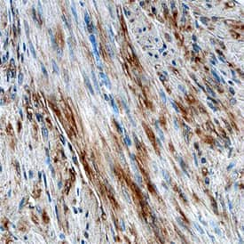 Vinculin was detected in immersion fixed paraffin-embedded sections of human uterus using Mouse Anti-Human Vinculin Monoclonal Antibody (Catalog # MAB68961) at 15 µg/mL overnight at 4 °C. Before incubation with the primary antibody, tissue was subjected to heat-induced epitope retrieval using Antigen Retrieval Reagent-Basic (Catalog # CTS013). Tissue was stained using the Anti-Mouse HRP-DAB Cell & Tissue Staining Kit (brown; Catalog # CTS002) and counterstained with hematoxylin (blue). Specific staining was localized to smooth muscle cells. View our protocol for Chromogenic IHC Staining of Paraffin-embedded Tissue Sections.