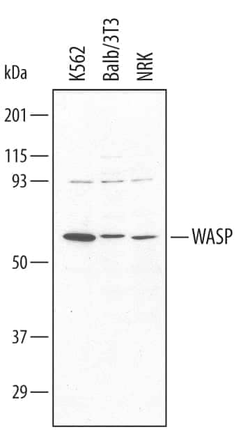 Western blot shows lysates of NRK rat normal kidney cell, K562 human chronic myelogenous leukemia cell line, and Balb/3T3 mouse embryonic fibroblast cell line. PVDF membrane was probed with 0.5 µg/mL of Goat Anti-Human/Mouse WASP Antigen Affinity-purified Polyclonal Antibody (Catalog # AF3070) followed by HRP-conjugated Anti-Goat IgG Secondary Antibody (Catalog # HAF019). A specific band was detected for WASP at approximately 60 kDa (as indicated). This experiment was conducted under reducing conditions and using Immunoblot Buffer Group 1.