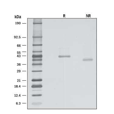 1 μg/lane ofRecombinant Mouse Wnt-8a (Catalog #  8419-WN)was resolved with SDS-PAGE under reducing (R) and non-reducing (NR) conditionsand visualized by silver staining, showing bands at 42.3 and 38.9 kDa, respectively.