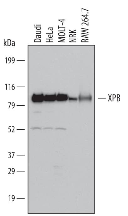 Western blot shows lysates of Daudi human Burkitt's lymphoma cell line, HeLa human cervical epithelial carcinoma cell line, MOLT-4 human acute lymphoblastic leukemia cell line, NRK rat normal kidney cell line, and RAW 264.7 mouse monocyte/macrophage cell line. PVDF Membrane was probed with 1 µg/mL of Goat Anti-Human/Mouse/Rat XPB Antigen Affinity-purified Polyclonal Antibody (Catalog # AF6349) followed by HRP-conjugated Anti-Goat IgG Secondary Antibody (Catalog # HAF017). A specific band was detected for XPB at approximately 86 kDa (as indicated). This experiment was conducted under reducing conditions and using Immunoblot Buffer Group 1.