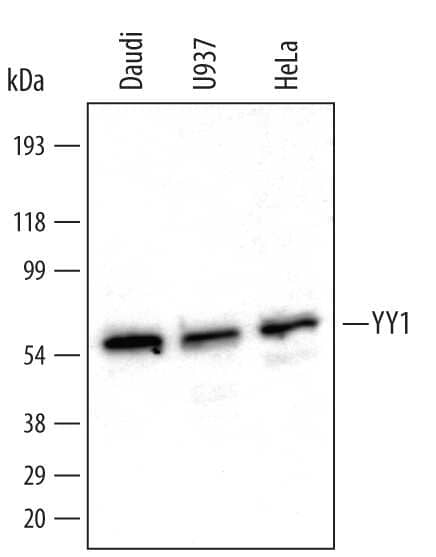 Western blot shows nuclear extracts of Daudi human Burkitt's lymphoma cell line, U937 human histiocytic lymphoma cell line, and HeLa human cervical epithelial carcinoma cell line. PVDF membrane was probed with 0.5 µg/mL of Goat Anti-Human YY1 Antigen Affinity-purified Polyclonal Antibody (Catalog # AF3784) followed by HRP-conjugated Anti-Goat IgG Secondary Antibody (Catalog # HAF109). A specific band was detected for YY1 at approximately 56 kDa (as indicated). This experiment was conducted under reducing conditions and using Immunoblot Buffer Group 1.