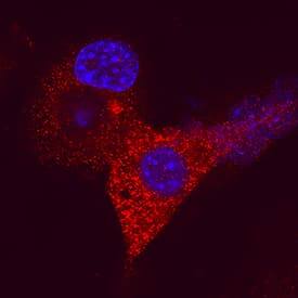 ZAG was detected in immersion fixed 3T3-L1 mouse embryonic fibroblast adipose-like cell line using Mouse Anti-Human ZAG Monoclonal Antibody (Catalog # MAB47641) at 25 µg/mL for 3 hours at room temperature. Cells were stained using the NorthernLights™ 557-conjugated Anti-Mouse IgG Secondary Antibody (red; Catalog # NL007) and counterstained with DAPI (blue). Specific staining was localized to cytoplasm. View our protocol for Fluorescent ICC Staining of Cells on Coverslips.