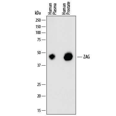 Western blot shows human plasma and lysates of human prostate tissue. PVDF membrane was probed with 1 µg/mL of Mouse Anti-Human ZAG Monoclonal Antibody (Catalog # MAB4764) followed by HRP-conjugated Anti-Mouse IgG Secondary Antibody (Catalog # HAF007). A specific band was detected for ZAG at approximately 41 kDa (as indicated). This experiment was conducted under reducing conditions and using Immunoblot Buffer Group 1.