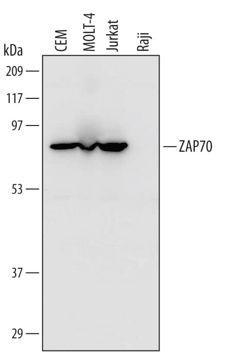 Western blot shows lysates of CEM human T-lymphoblastoid cell line, MOLT‑4 human acute lymphoblastic leukemia cell line, Jurkat human acute T cell leukemia cell line, and Raji human Burkitt's lymphoma cell line. PVDF Membrane was probed with 1 µg/mL of Mouse Anti-Human ZAP70 Monoclonal Antibody (Catalog # MAB3709) followed by HRP-conjugated Anti-Mouse IgG Secondary Antibody (Catalog # HAF007). A specific band was detected for ZAP70 at approximately 70 kDa (as indicated). This experiment was conducted under reducing conditions and using Immunoblot Buffer Group 1.