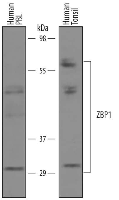 Western blot shows lysates of human peripheral blood lymphocytes (PBL) and human tonsil tissue. PVDF membrane was probed with 1 µg/mL of Sheep Anti-Human ZBP1/DLM-1/DAI Antigen Affinity-purified Polyclonal Antibody (Catalog # AF6309) followed by HRP-conjugated Anti-Sheep IgG Secondary Antibody (Catalog # HAF016). Specific bands were detected for ZBP1/DLM-1/DAI at approximately 30-60 kDa (as indicated). This experiment was conducted under reducing conditions and using Immunoblot Buffer Group 1.