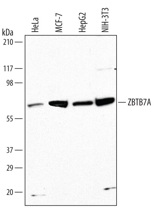 Western blot shows lysates of HeLa human cervical epithelial carcinoma cell line, MCF-7 human breast cancer cell line, HepG2 human hepatocellular carcinoma cell line, and NIH-3T3 mouse embryonic fibroblast cell line. PVDF Membrane was probed with 1 µg/mL of Mouse Anti-Human/Mouse ZBTB7A/Pokemon Monoclonal Antibody (Catalog # MAB3496) followed by HRP-conjugated Anti-Mouse IgG Secondary Antibody (Catalog # HAF007). A specific band was detected for ZBTB7A/Pokemon at approximately 75 kDa (as indicated). This experiment was conducted under reducing conditions and using Immunoblot Buffer Group 10.