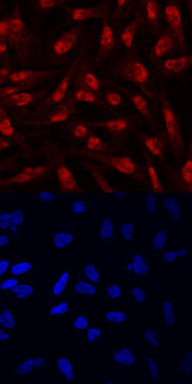 ZEB1 was detected in immersion fixed MDA-MB-231 human breast cancer cell line using Mouse Anti-Human ZEB1 Monoclonal Antibody (Catalog # MAB6708) at 10 µg/mL for 3 hours at room temperature. Cells were stained using the NorthernLights™ 557-conjugated Anti-Mouse IgG Secondary Antibody (red, upper panel; Catalog # NL007) and counterstained with DAPI (blue, lower panel). Specific staining was localized to nuclei and cytoplasm. View our protocol for Fluorescent ICC Staining of Cells on Coverslips.