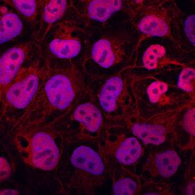 ZIC1 was detected in immersion fixed human plasmid-derived induced pluripotent stem cells (iPSK3) using Goat Anti-Human/Mouse ZIC1 Antigen Affinity-purified Polyclonal Antibody (Catalog # AF4978) at 10 µg/mL for 3 hours at room temperature. Cells were stained using the NorthernLights™ 557-conjugated Anti-Goat IgG Secondary Antibody (red; Catalog # NL001) and counterstained with DAPI (blue). Specific staining was localized to nuclei and cytoplasm. View our protocol for Fluorescent ICC Staining of Stem Cells on Coverslips.