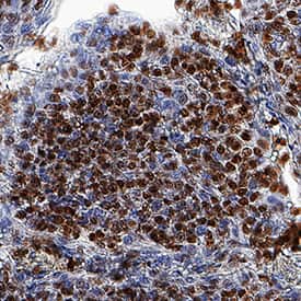 Immunohistochemistry ZNF10 Antibody (980803) [Unconjugated]