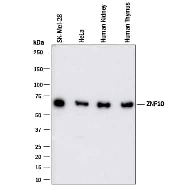 Western Blot ZNF10 Antibody (980809) [Unconjugated]