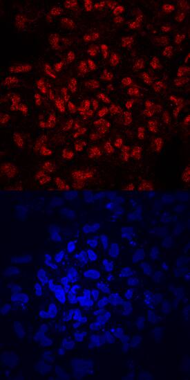 ZNF143 was detected in immersion fixed BG01V human embryonic stem cells using Mouse Anti-Human ZNF143 Monoclonal Antibody (Catalog # MAB6804) at 10 µg/mL for 3 hours at room temperature. Cells were stained using the NorthernLights™ 557-conjugated Anti-Mouse IgG Secondary Antibody (red, upper panel; Catalog # NL007) and counterstained with DAPI (blue, lower panel). Specific staining was localized to nuclei. View our protocol for Fluorescent ICC Staining of Cells on Coverslips.