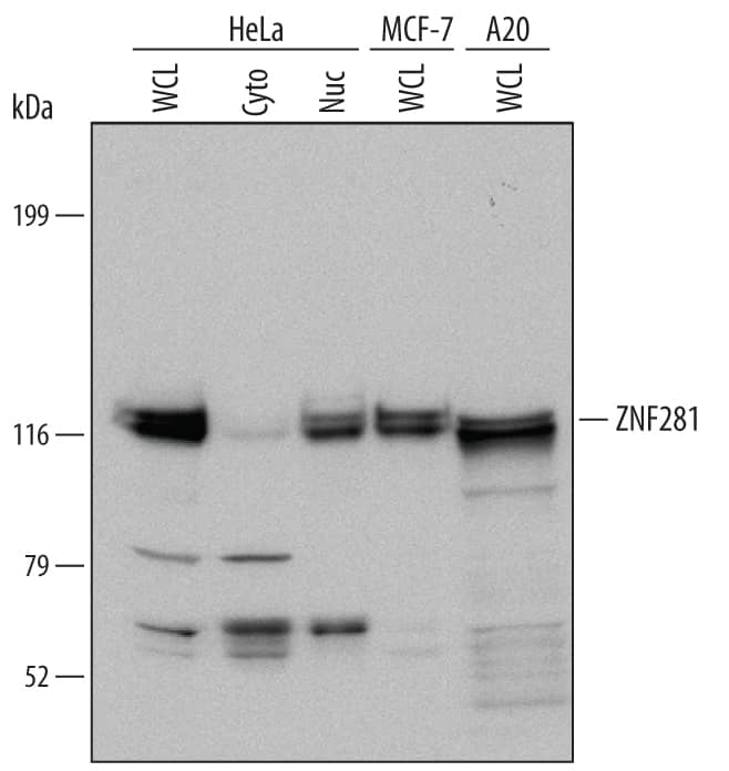Western blot shows lysates of HeLa human cervical epithelial carcinoma cell line, MCF-7 human breast cancer cell line, and A20 mouse B cell lymphoma cell line. Gels were loaded with whole cell lysate (WCL), cytoplasmic (Cyto), and nuclear extracts (Nuc). PVDF Membrane was probed with 1 µg/mL of Sheep Anti-Human/Mouse ZNF281 Antigen Affinity-purified Polyclonal Antibody (Catalog # AF6350) followed by HRP-conjugated Anti-Sheep IgG Secondary Antibody (Catalog # HAF016). A specific band was detected for ZNF281 at approximately 117 kDa (as indicated). This experiment was conducted under reducing conditions and using Immunoblot Buffer Group 1.