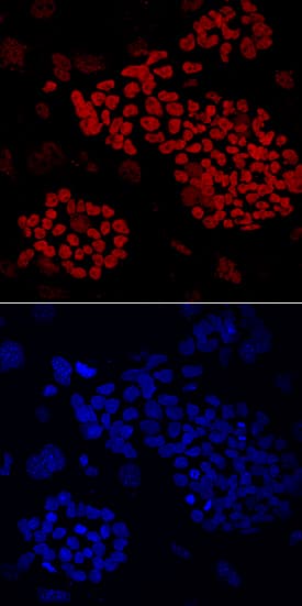 ZNF281 was detected in immersion fixed BG01V human embryonic stem cells using Mouse Anti-Human ZNF281 Monoclonal Antibody (Catalog # MAB6350) at 10 µg/mL for 3 hours at room temperature. Cells were stained using the NorthernLights™ 557-conjugated Anti-Mouse IgG Secondary Antibody (red, upper panel; Catalog # NL007) and counterstained with DAPI (blue, lower panel). Specific staining was localized to nuclei. View our protocol for Fluorescent ICC Staining of Stem Cells on Coverslips.