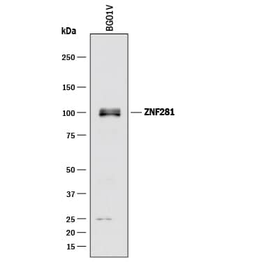 Western blot shows lysates of BG01V human embryonic stem cells. PVDF membrane was probed with 1 µg/mL of Mouse Anti-Human ZNF281 Monoclonal Antibody (Catalog # MAB6350) followed by HRP-conjugated Anti-Mouse IgG Secondary Antibody (Catalog # HAF018). A specific band was detected for ZNF281 at approximately 100 kDa (as indicated). This experiment was conducted under reducing conditions and using Immunoblot Buffer Group 1.