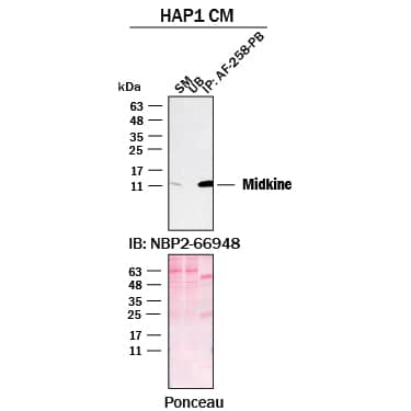 Immunoprecipitation was performed on concentrated culture media of HAP1 human near-haploid cell line using 2.0 μg of Mouse Anti-Human Midkine Monoclonal Antibody (Catalog # AF-258-PB) pre-coupled to protein G or protein A beads.  Immunoprecipitated Midkine was detected with Rabbit Anti-Human Midkine Monoclonal Antibody (NBP2-66948 ) at 1/500. The Ponceau stained transfers of each blot are shown. SM=10% starting material; UB=10% unbound fraction; IP=immunoprecipitated.  Image, protocol, and testing courtesy of YCharOS Inc. (ycharos.com).