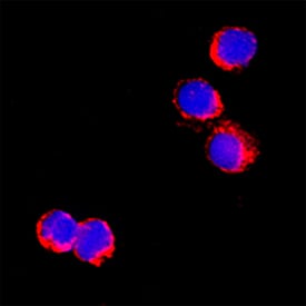 IL‑5 was detected in immersion fixed feline peripheral blood mononuclear cells (PBMCs) using Goat Anti-Feline IL‑5 Antigen Affinity-purified Polyclonal Antibody (Catalog # AF1795) at 15 µg/mL for 3 hours at room temperature. Cells were stained using the NorthernLights™ 557-conjugated Anti-Goat IgG Secondary Antibody (red; NL001) and counterstained with DAPI (blue). Specific staining was localized to cytoplasm. Staining was performed using our protocol for Fluorescent ICC Staining of Non-adherent Cells.