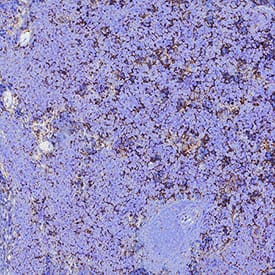 CD47 was detected in immersion fixed paraffin-embedded sections of Mouse Spleen using Goat Anti-Mouse/Rat CD47 N-terminal IgV-like Extracellular Domain Antigen Affinity-purified Polyclonal Antibody (Catalog # AF1866) at 1 µg/mL for 1 hour at room temperature followed by incubation with the Anti-Mouse IgG VisUCyte™ HRP Polymer Antibody (Catalog # VC001). Before incubation with the primary antibody, tissue was subjected to heat-induced epitope retrieval using VisUCyte Antigen Retrieval Reagent-Basic (Catalog # VCTS021). Tissue was stained using DAB (brown) and counterstained with hematoxylin (blue). Specific staining was localized to Cell surface and cytoplasm. View our protocol for IHC Staining with VisUCyte HRP Polymer Detection Reagents.