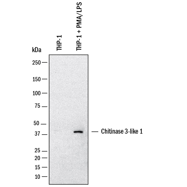 Western Blot Chitinase 3-like 1/YKL-40 Antibody [Unconjugated]